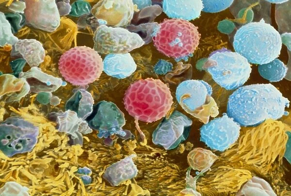 Coloured SEM of trachea surface with pollen & dust