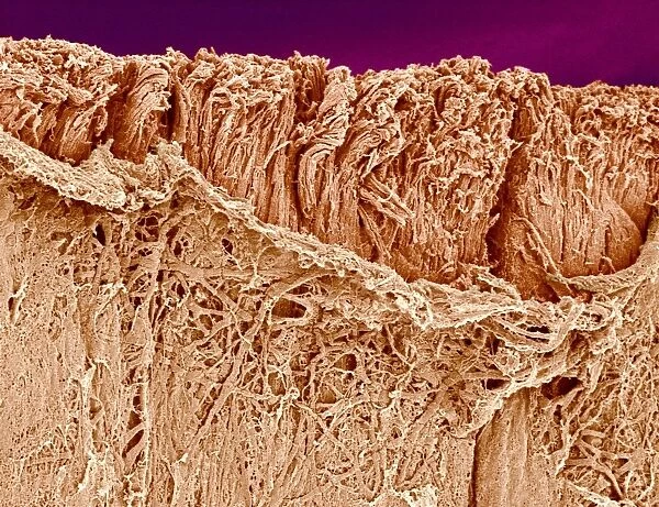 Trachea muscle, SEM C015  /  9935