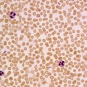 LM of a field of red and white blood cells