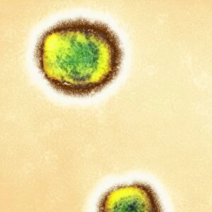 Monkeypox virus particles, TEM C016 / 7387